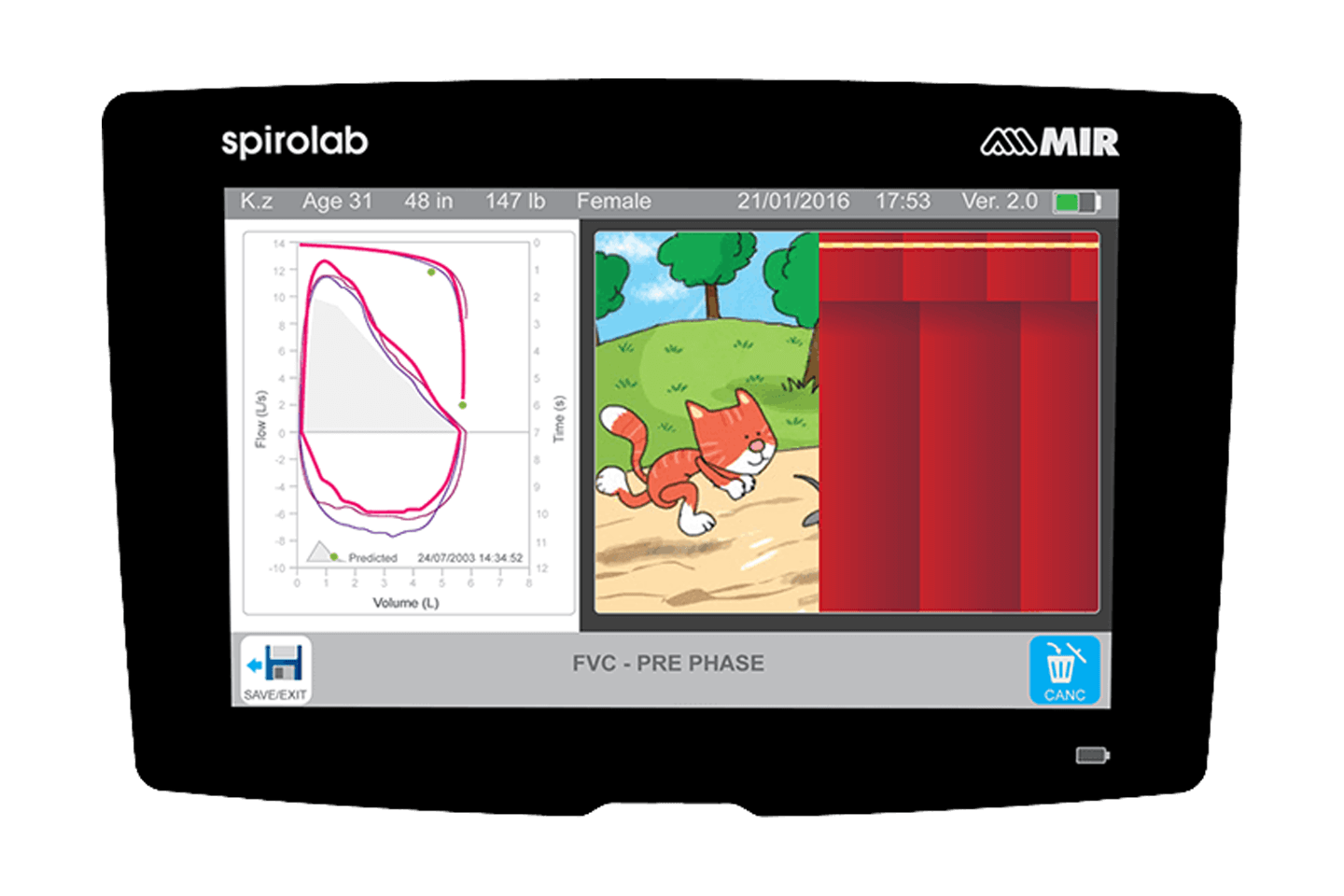 MIR Spirolab Spirometer Desktop and PC-Based Spirometer with Oximetry ...